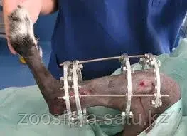 Остеосинтез (хирургическое лечение сложных переломов